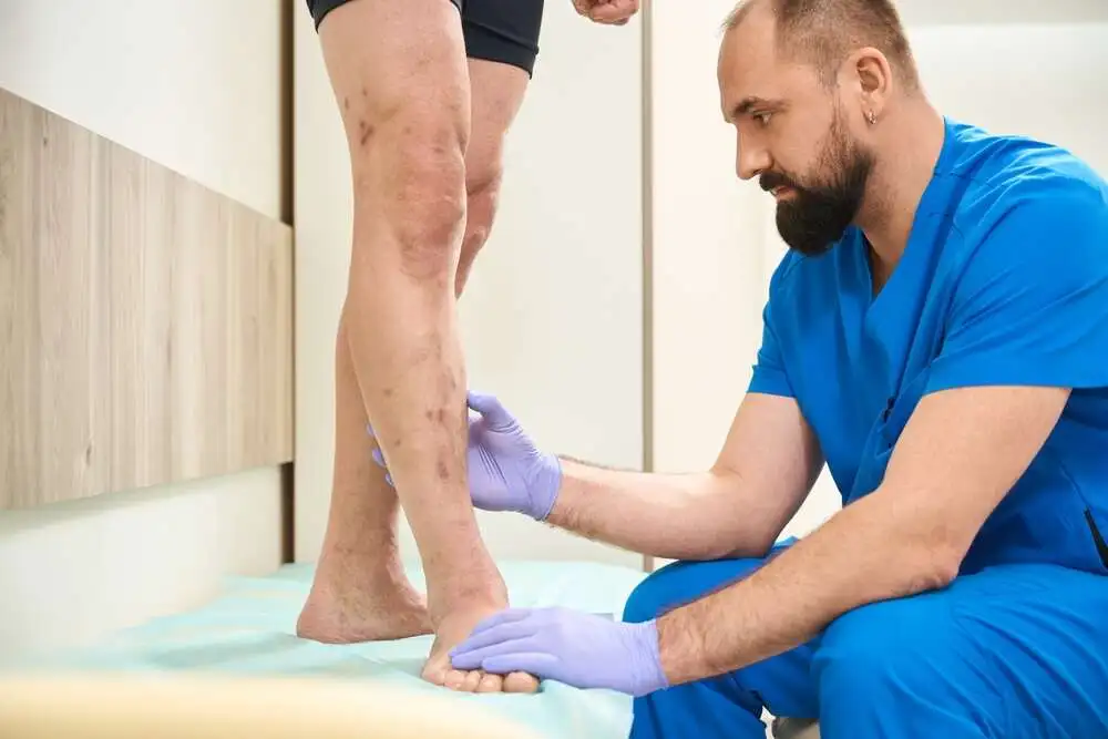 PAD Treatment Options Conservative to Interventional